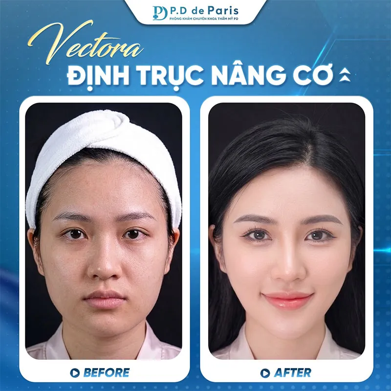 Review đánh giá khách hàng về Phòng khám PTTM Pd De Paris có tốt và an toàn không?