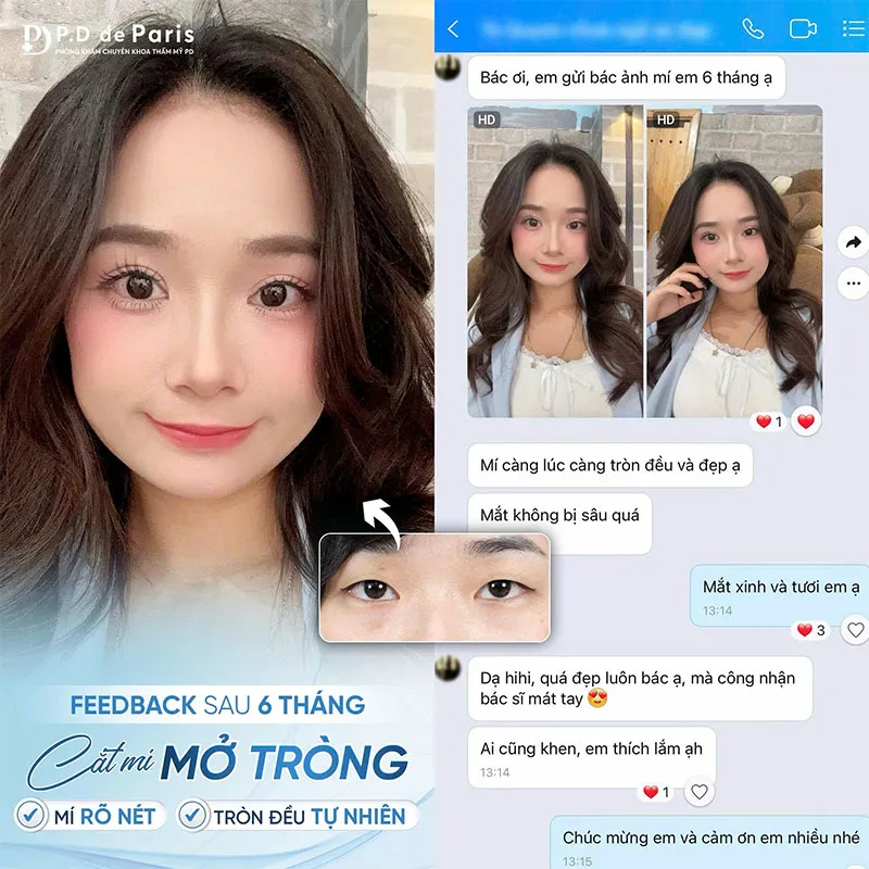 Review đánh giá khách hàng về Phòng khám PTTM Pd De Paris có tốt và an toàn không?