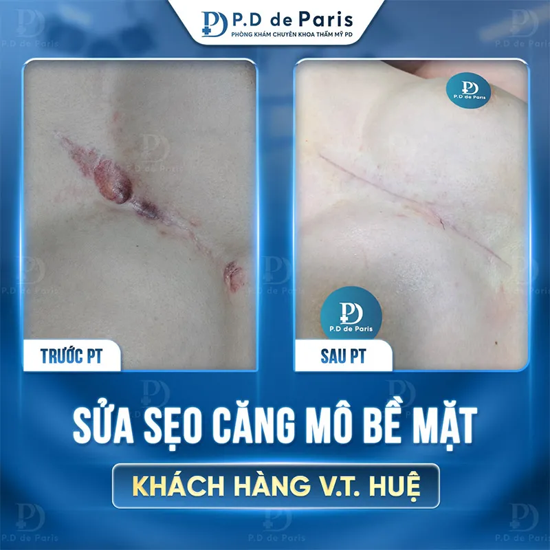Phòng khám PTTM Pd De Paris có tốt và an toàn không?